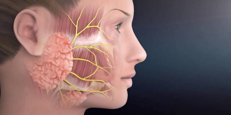 Защемление лицевого нерва